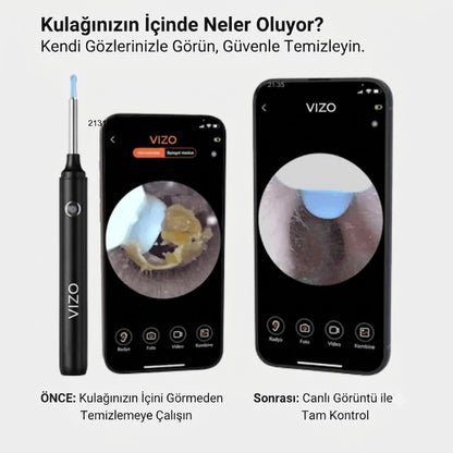 Vizo Kameralı Kulak Temizleme Cihazı
