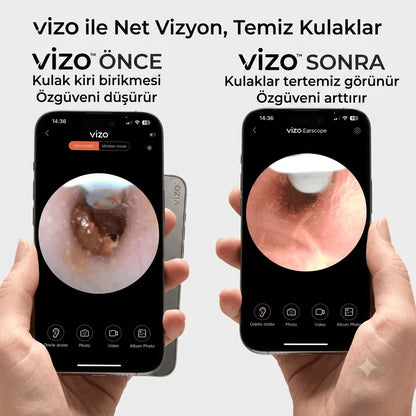 Vizo Kameralı Kulak Temizleme Cihazı